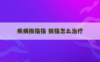 疾病扳指指 扳指怎么治疗